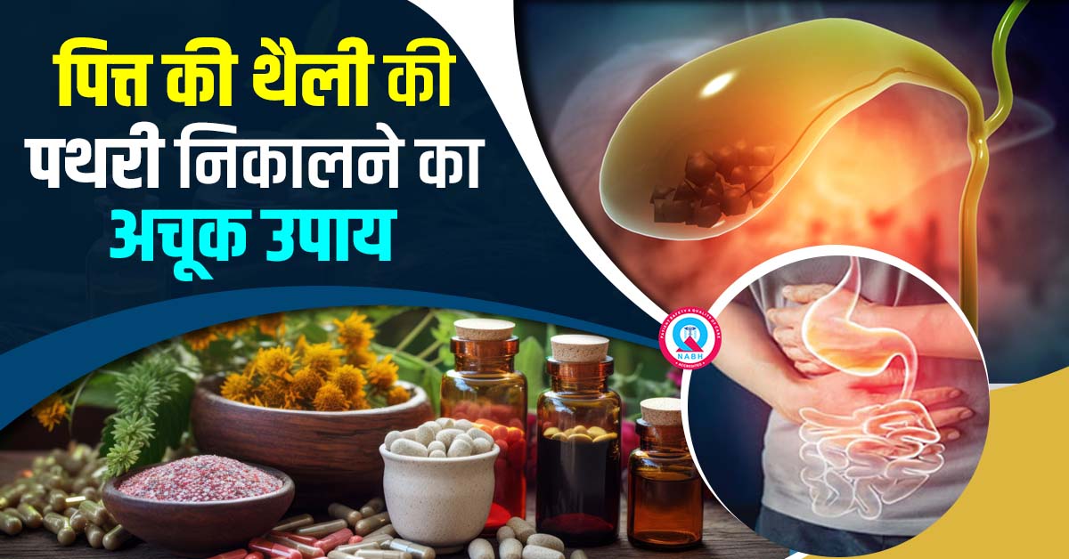 पित्त-की-थैली-की-पथरी-निकालने-का-अचूक-उपाय
